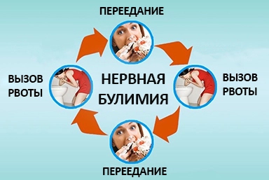 Лечение булимии в Медведово